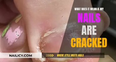 The Mystery of Cracked Nails: What Your Body Is Telling You