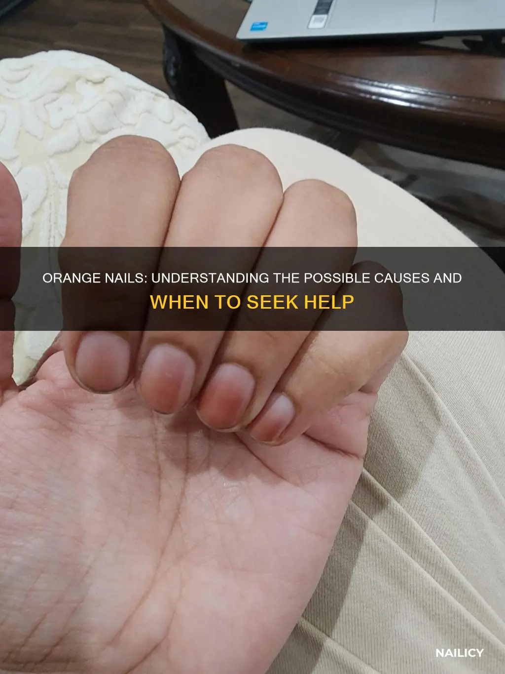 what does it mean if my nails are orange