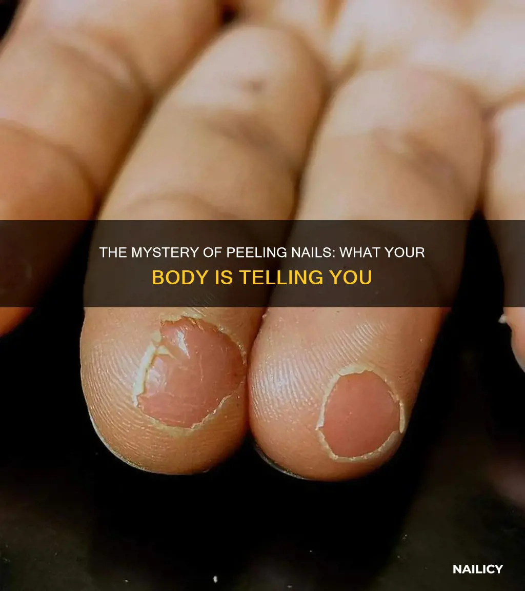 what does it mean if my nails are peeling