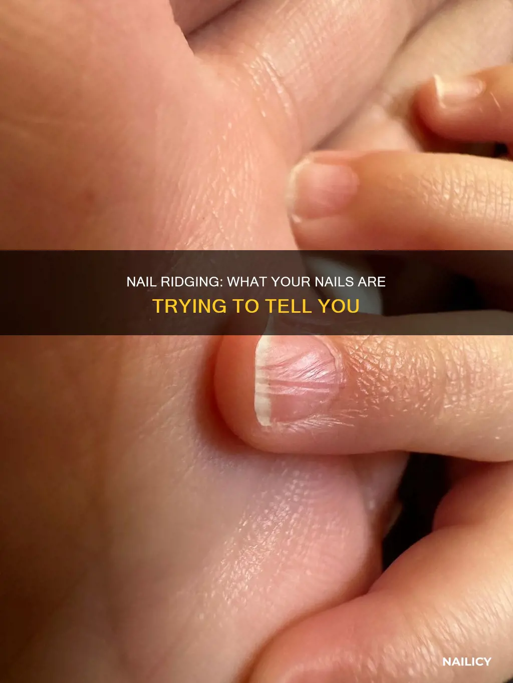 what does it mean if my nails are ridged