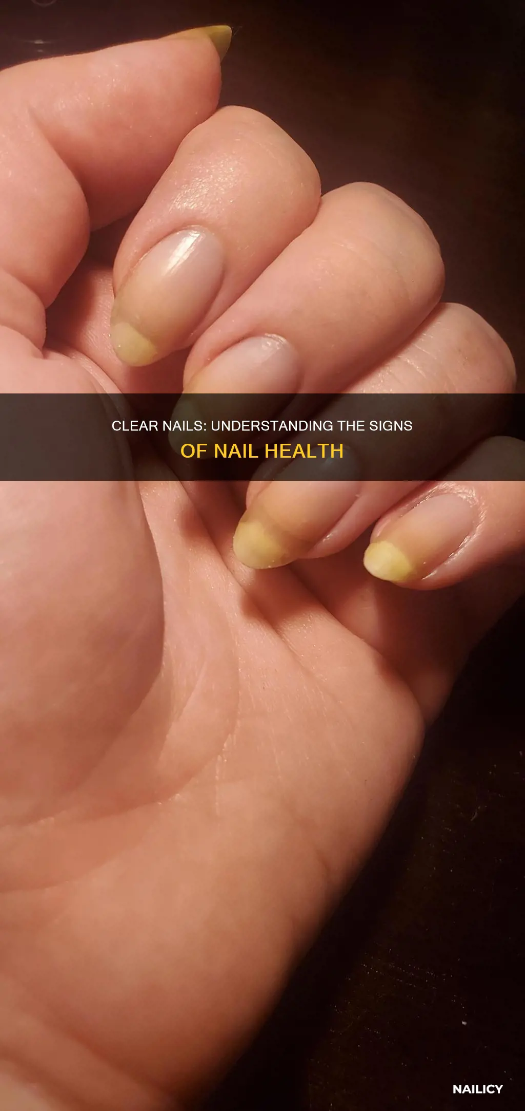 what does it mean if my nails are see through