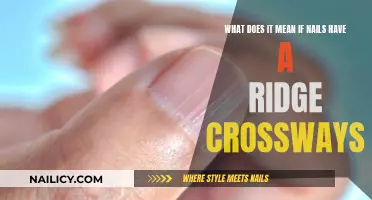 Understanding Ridge Crossways in Nails: Causes and Solutions