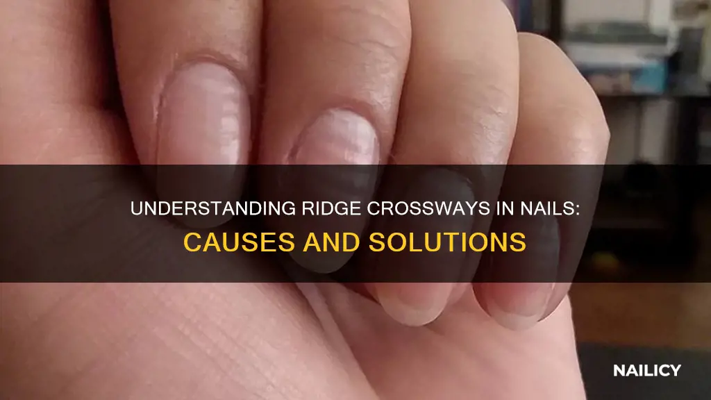 what does it mean if nails have a ridge crossways