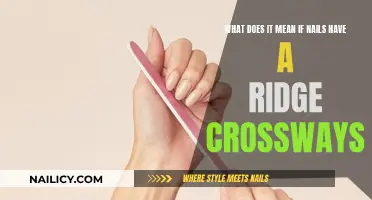Ridges on Nails: What Do They Mean?