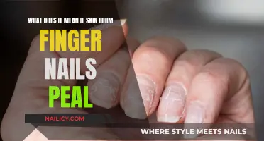 Unraveling the Mystery: Why Your Skin Peels Around Nails