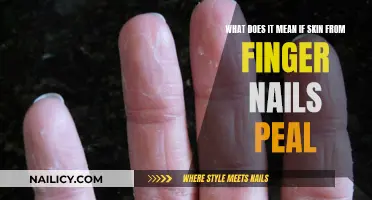 Skin Peeling from Nails: What Does It Mean?