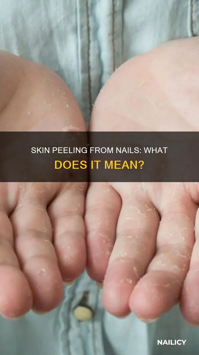 what does it mean if skin from finger nails peal