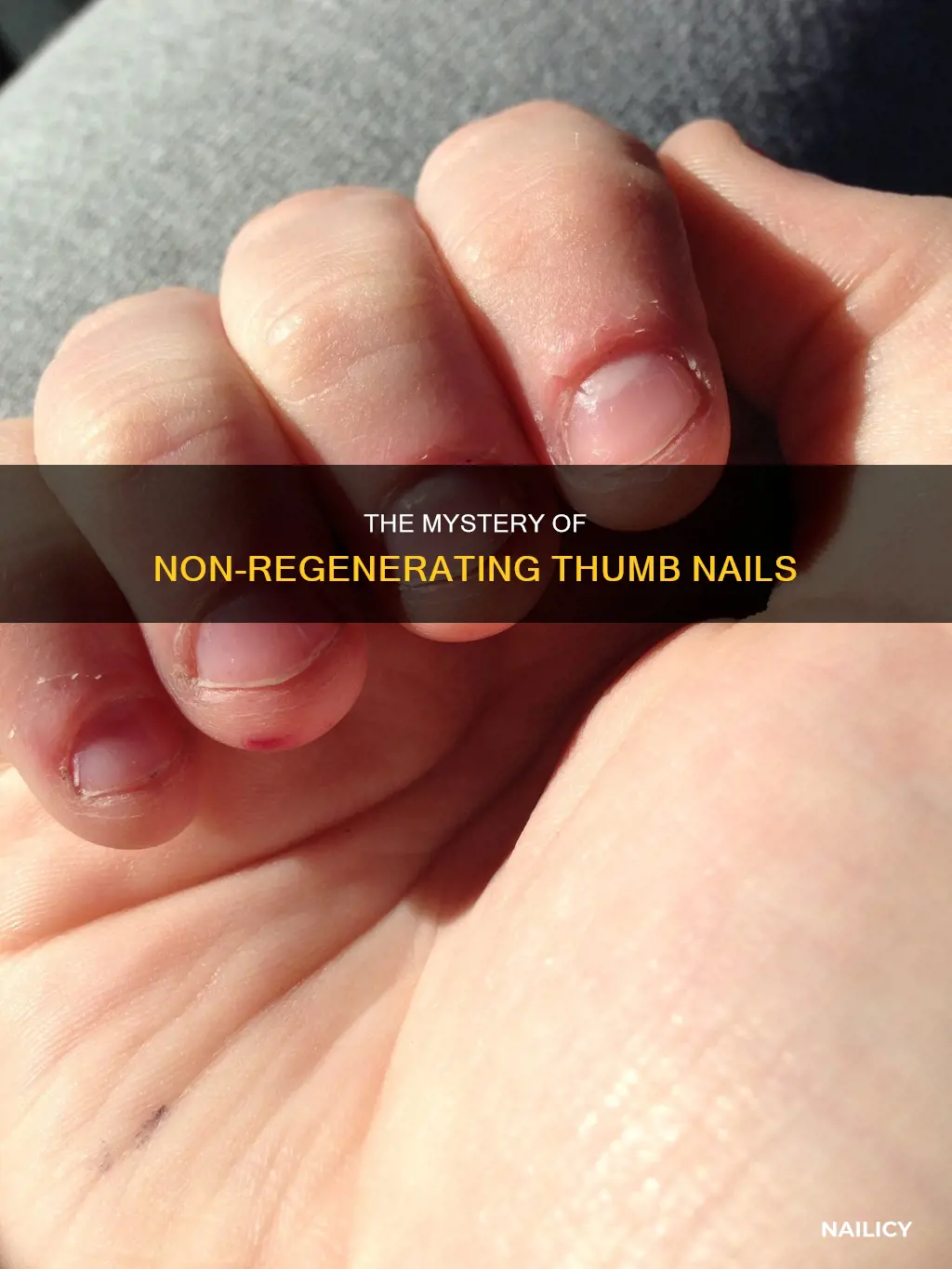 what does it mean if thumb nail doesn