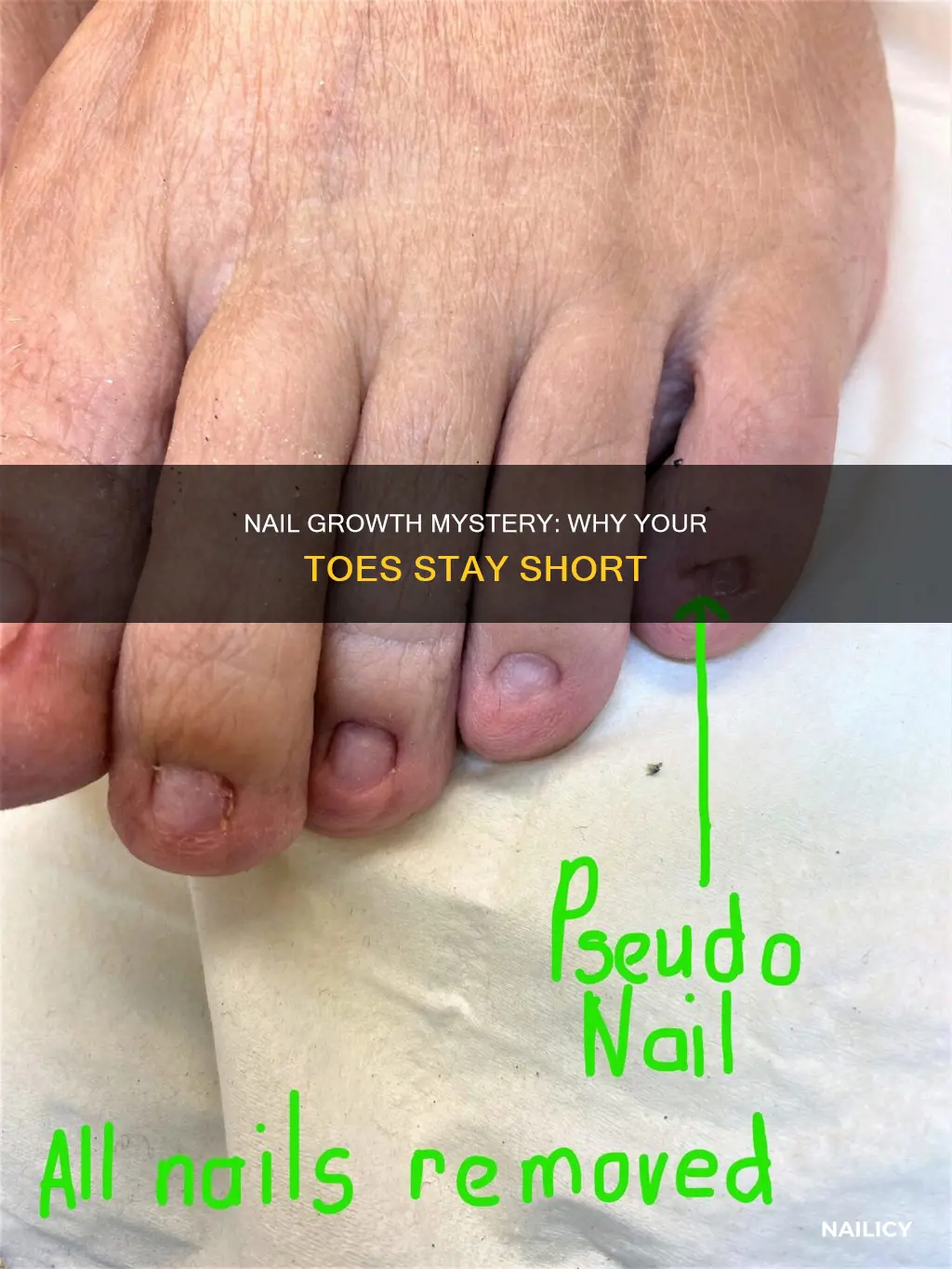 what does it mean if toe nails dont grow