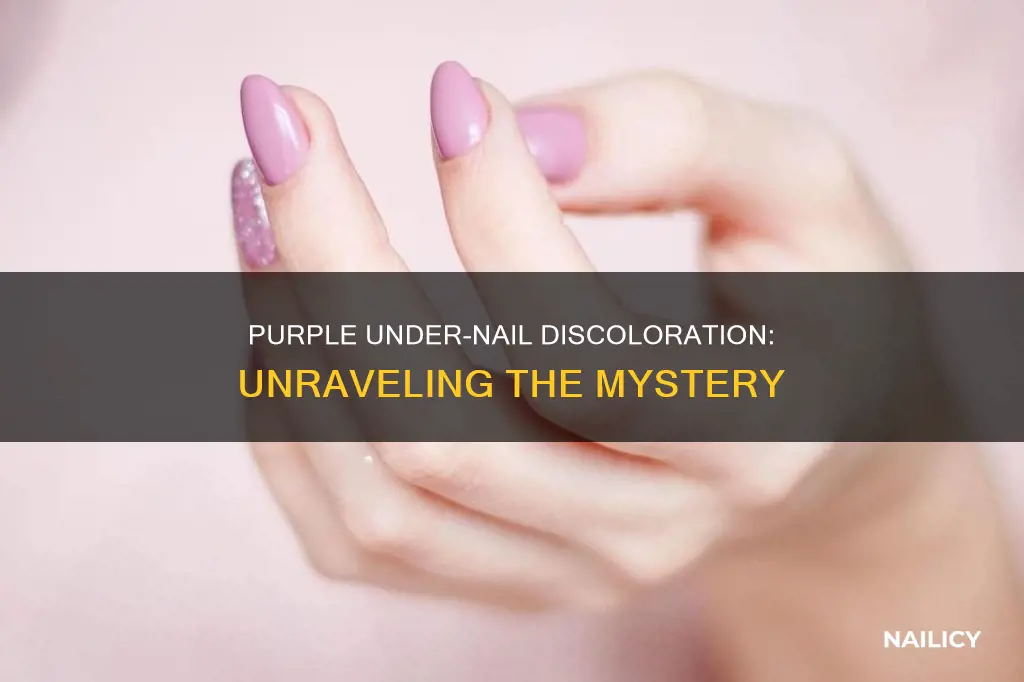 what does it mean if under your nails are purple