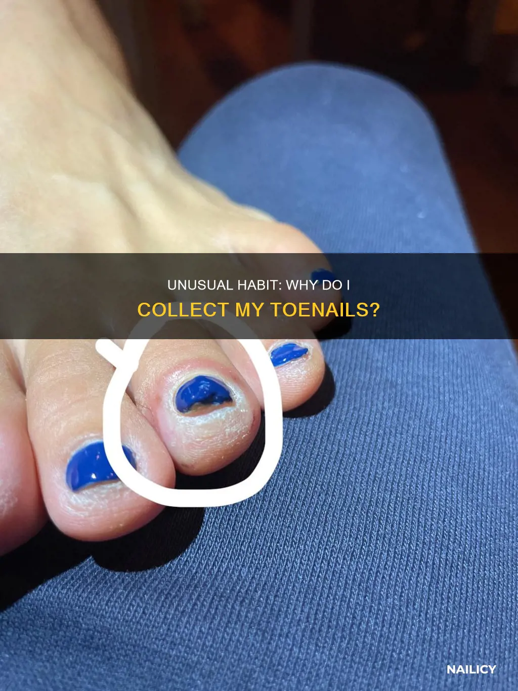 what does it mean if you collect your toe nails