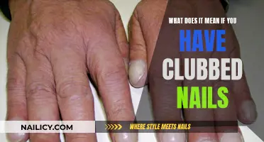 Clubbed Nails: Understanding the Condition and Its Causes