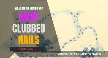 Clubbed Nails: What They Mean for Your Health