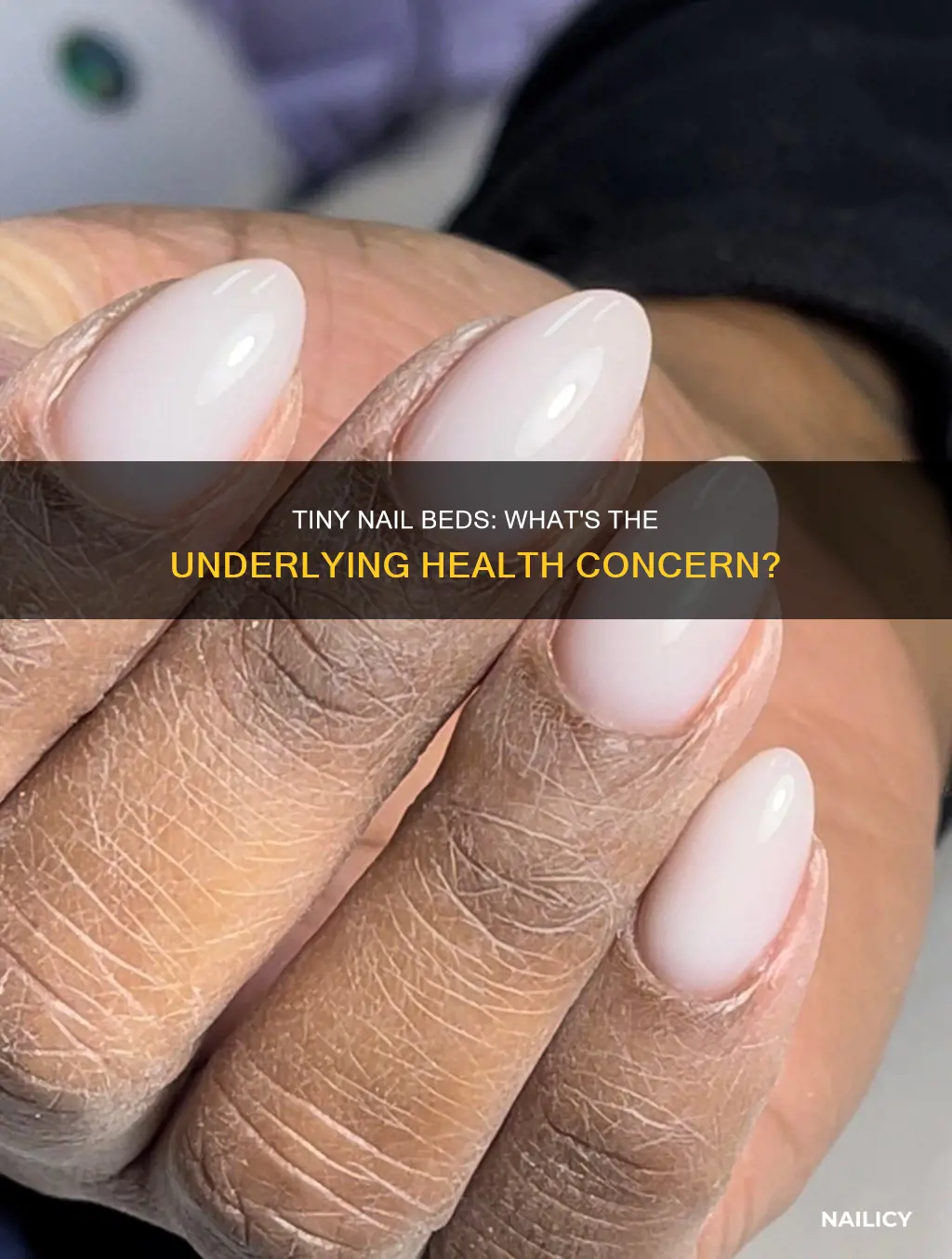 what does it mean if you have tiny nail beds