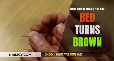 Nail Bed Turning Brown: What Does It Mean?