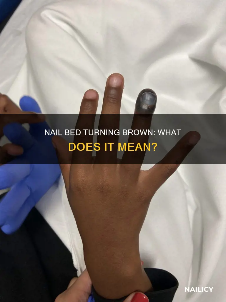 what does it mean if you nail bed turns brown