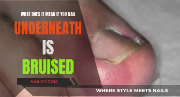 Why Are Your Nails Bruised?
