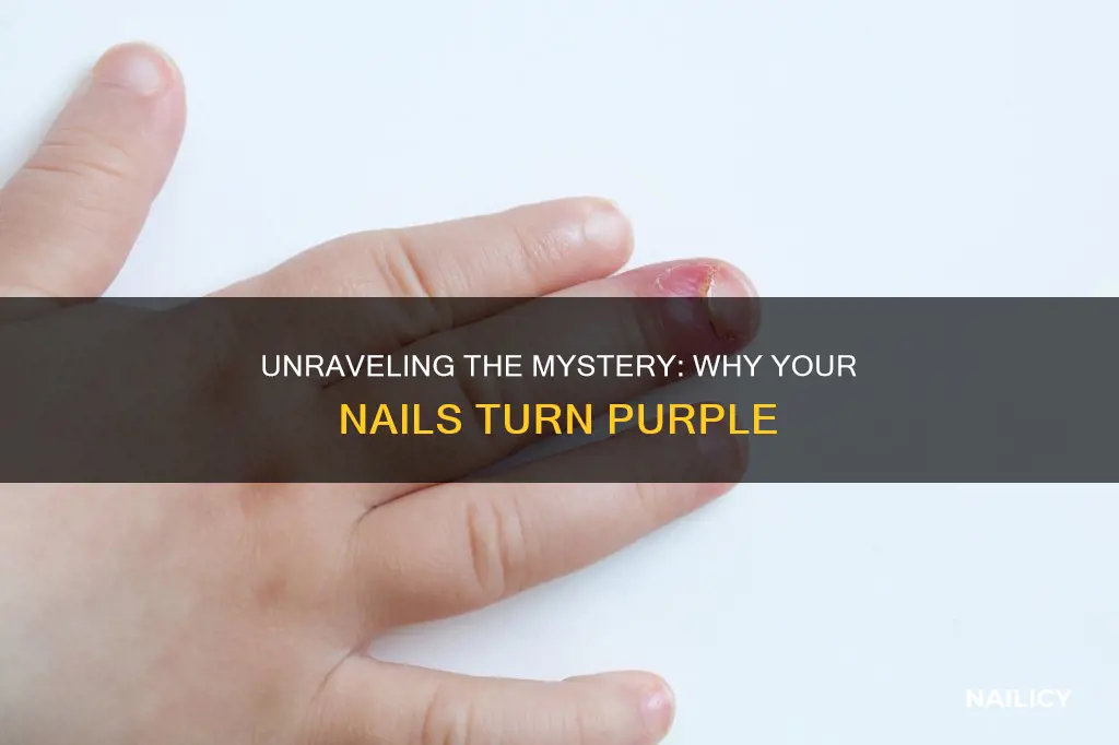 what does it mean if your finger nails are purple