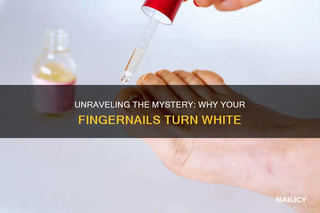 what does it mean if your finger nails are white