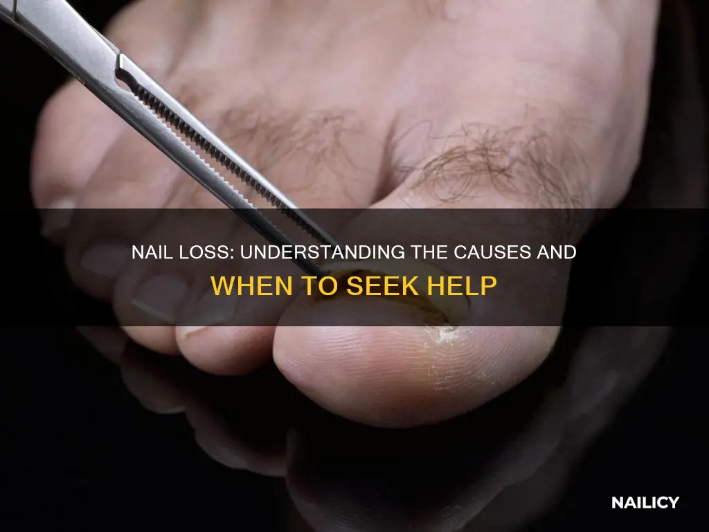 what does it mean if your nail falls off