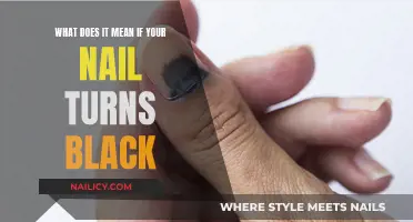 Nail Darkening: Understanding the Causes and When to Seek Help