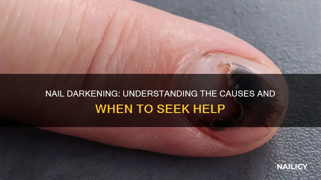 what does it mean if your nail turns black