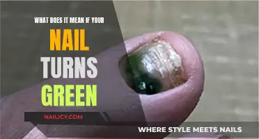 Nail Color Change: Understanding the Green Alert