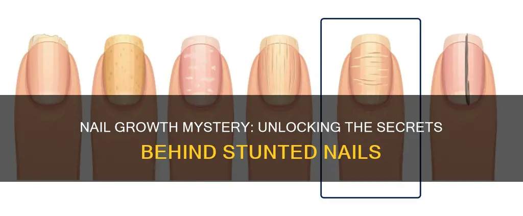 what does it mean if your nails are not growing