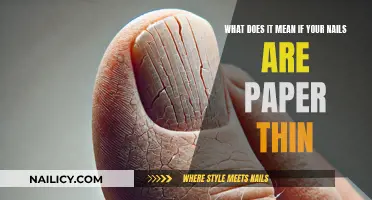 The Mystery of Paper-Thin Nails: What's the Cause?