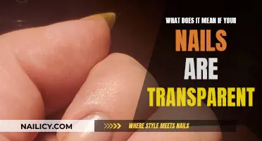 Nail Transparency: Unveiling Hidden Health Clues