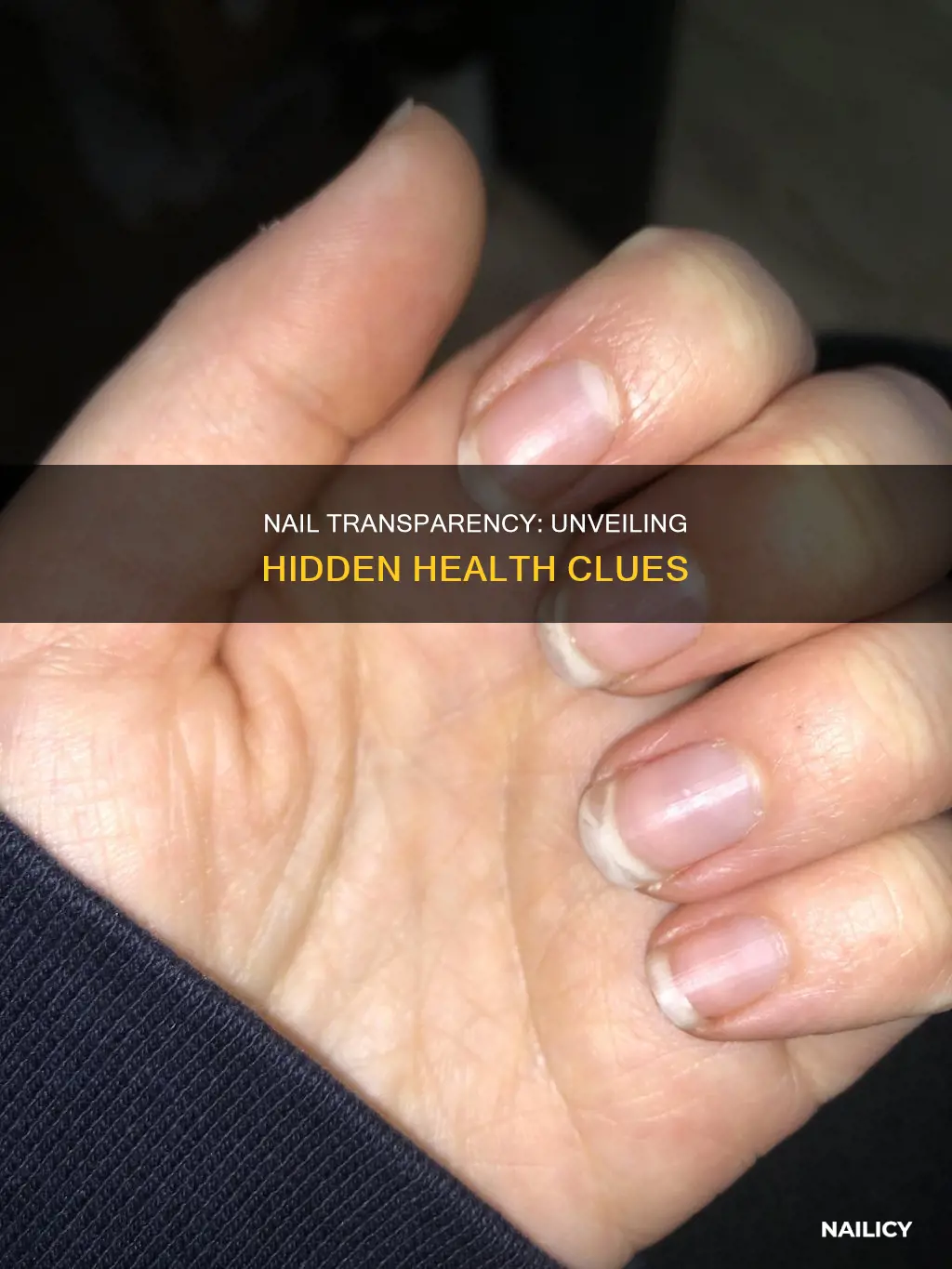 what does it mean if your nails are transparent