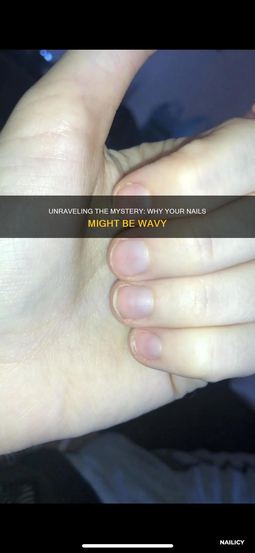 what does it mean if your nails are wavy