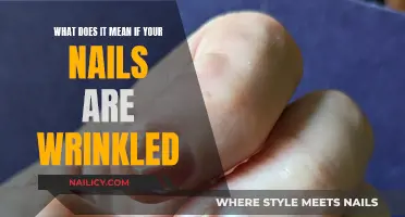 Unravel the Mystery: Why Your Nails Might Be Wrinkled