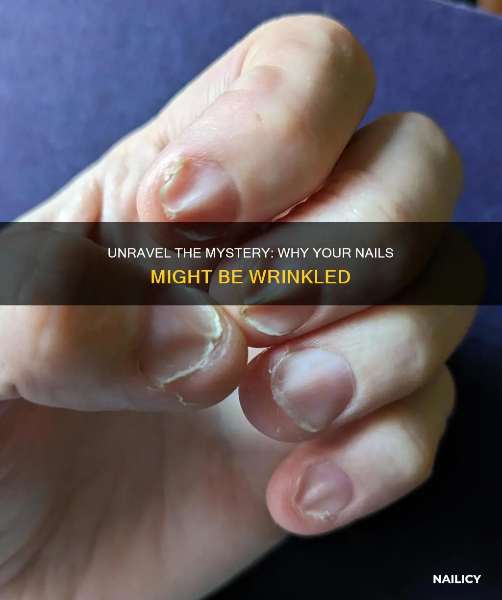 what does it mean if your nails are wrinkled