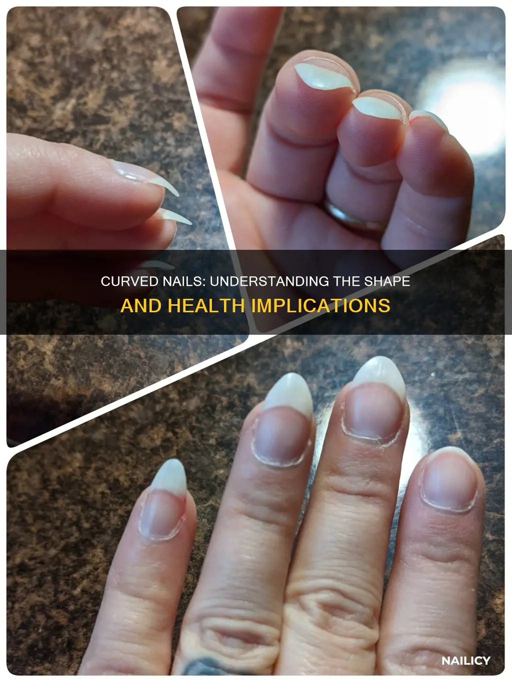 what does it mean if your nails grow curved