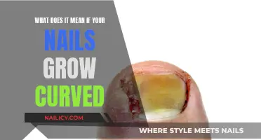 Curved Nails: What Your Body Is Trying to Tell You
