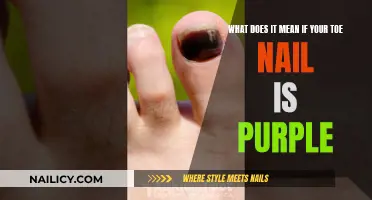 Purple Toe Nail: Understanding the Color Change