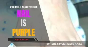 Toe Nail Turning Purple: What Does It Mean?