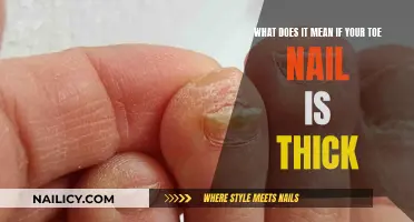 Thick Toe Nail: Causes, Treatments, and When to See a Doctor