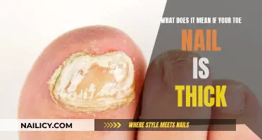 Thick Toenail: What Does It Mean?