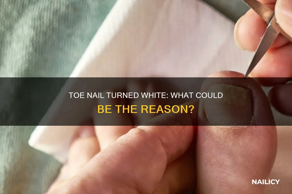 what does it mean if your toe nail is white