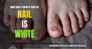 White Toenails: What Does It Mean?