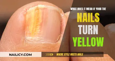 Yellow Toenails: Unraveling the Mystery Behind the Color Change