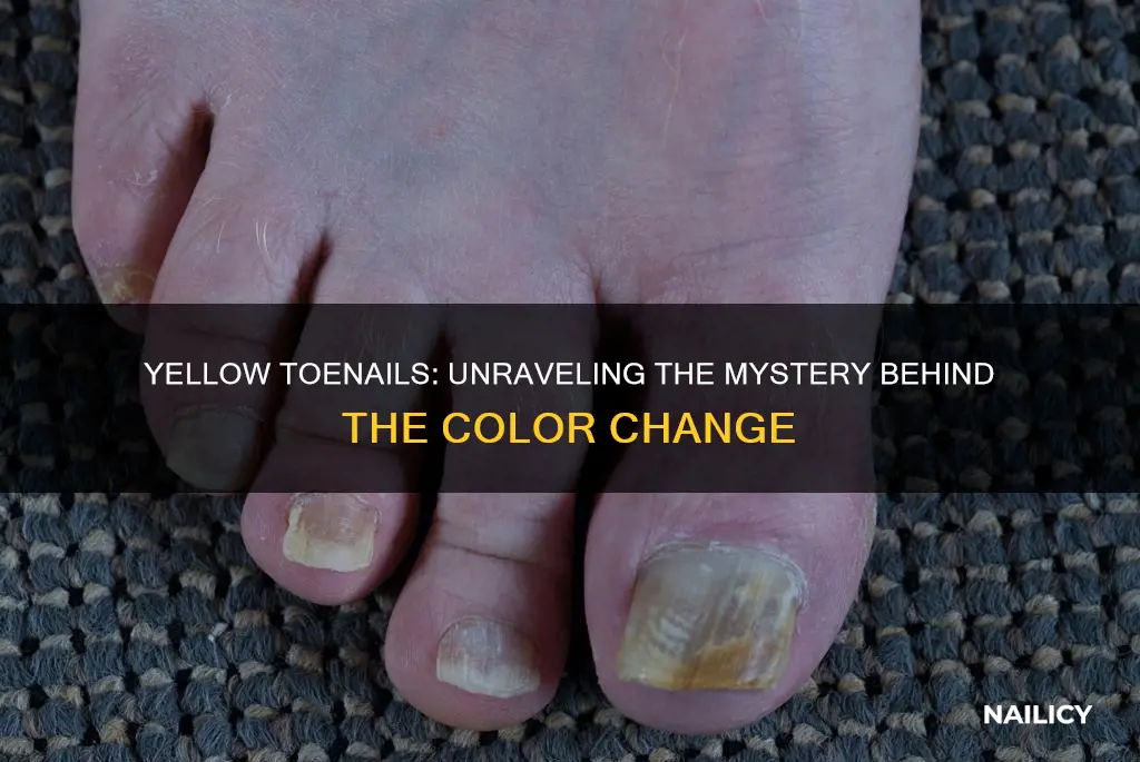 what does it mean if your toe nails turn yellow