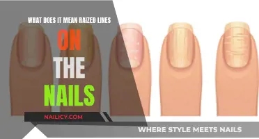 Raised Lines on Nails: What Your Body is Telling You