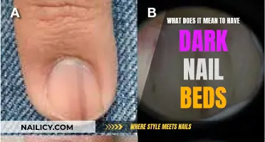 The Mystery of Dark Nail Beds: What Does it Mean?