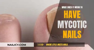 Understanding the Signs: What You Need to Know About Mycotic Nails