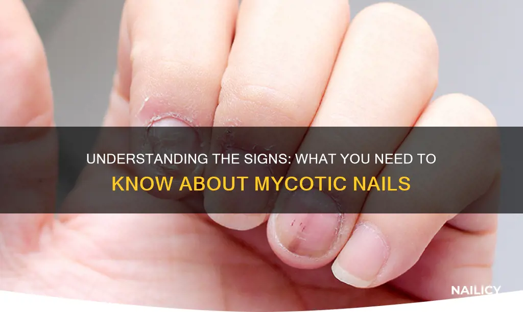 what does it mean to have mycotic nails