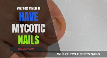 Understanding Onychomycosis: Treating and Preventing Fungal Nail Infections
