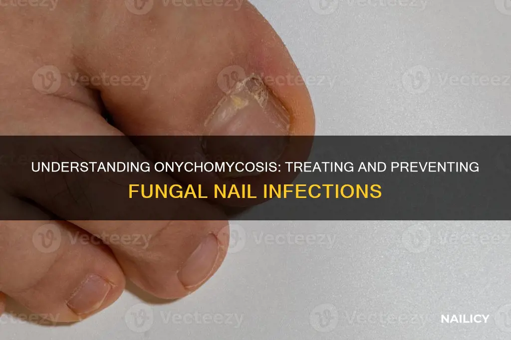 what does it mean to have mycotic nails